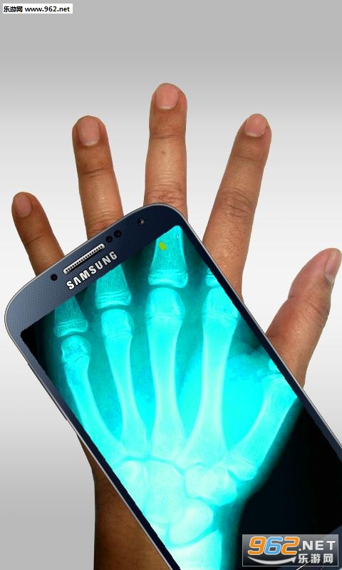 Xray(X����ɨ����app)v1.0��ͼ1