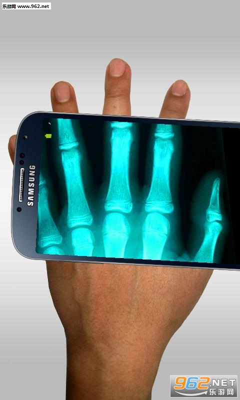 Xray(X����ɨ����app)v1.0��ͼ2