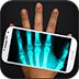 Xray(X����ɨ����app)