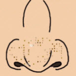NoseOil(����ͷ(Squeeze Nose Pore Nyurutto)��Ϸ������)