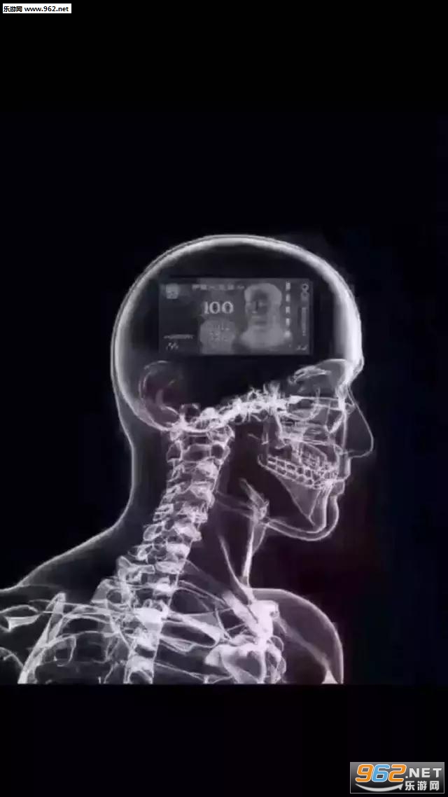 ����ctͼ����һ������Ҹ���ͼƬ��ͼ3