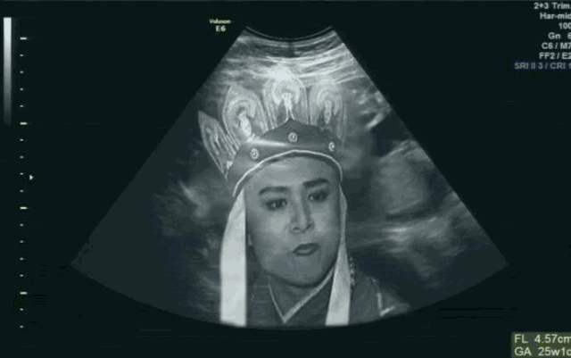 抖音怀孕恶搞b超图片 抖音怀孕恶搞b超图片