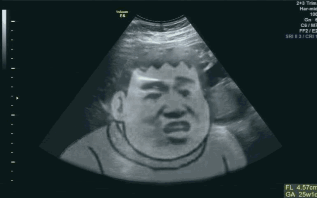 抖音怀孕恶搞b超图片 抖音怀孕恶搞b超图片