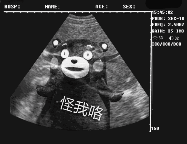 抖音怀孕恶搞b超图片 抖音怀孕恶搞b超图片
