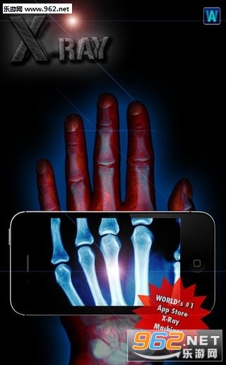 X����ɨ����appv1.6��ͼ2