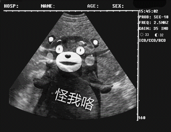 B����·ͼ��ͼ4