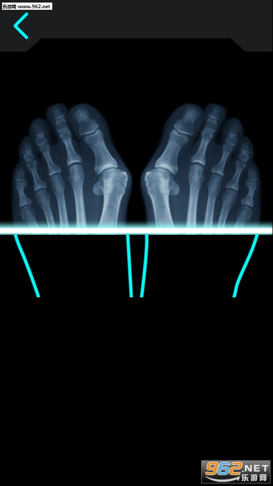 Real XRay Simulator(��ʵX����ģ�����ֻ���)v1.0��ͼ0