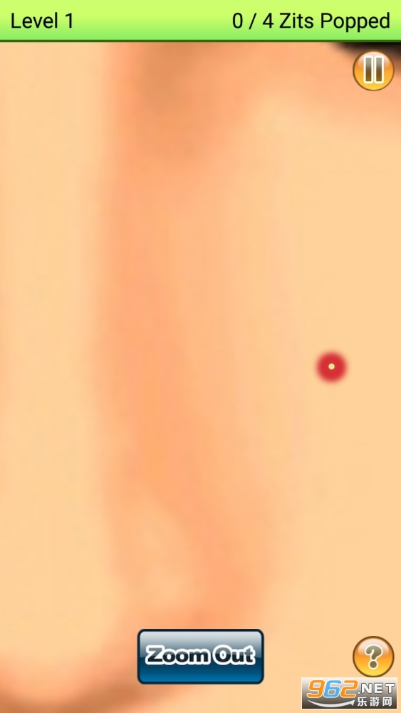pimple popping���°��ͼ2