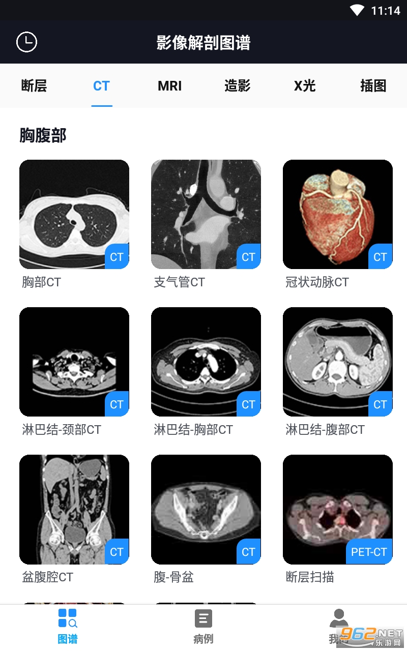 Ӱ�����ͼ��appv3.1.1 �ٷ����ͼ1