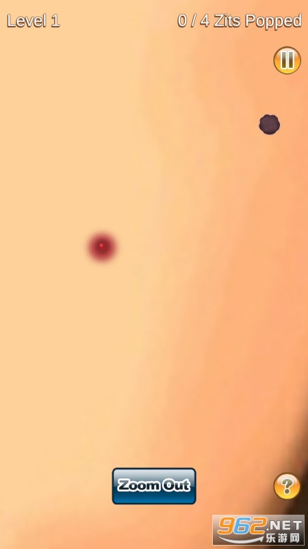 Pimple Popper��Ϸ