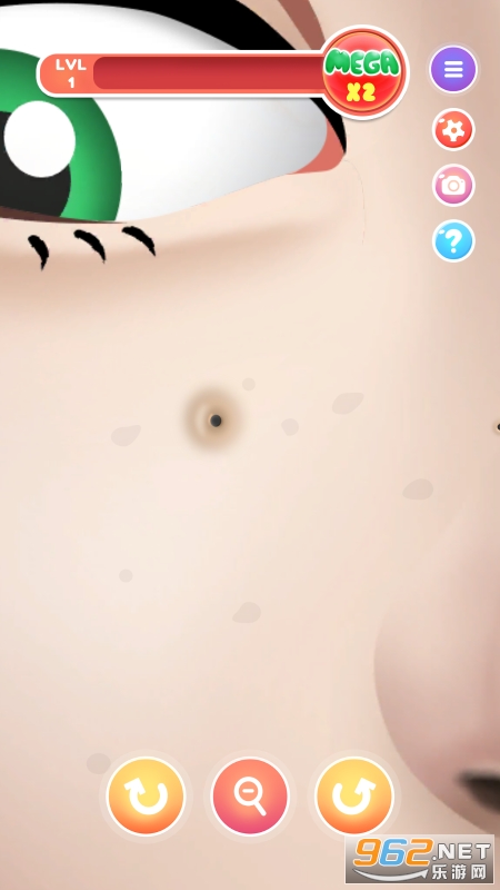 Mega Pimple Popper��ͼ1