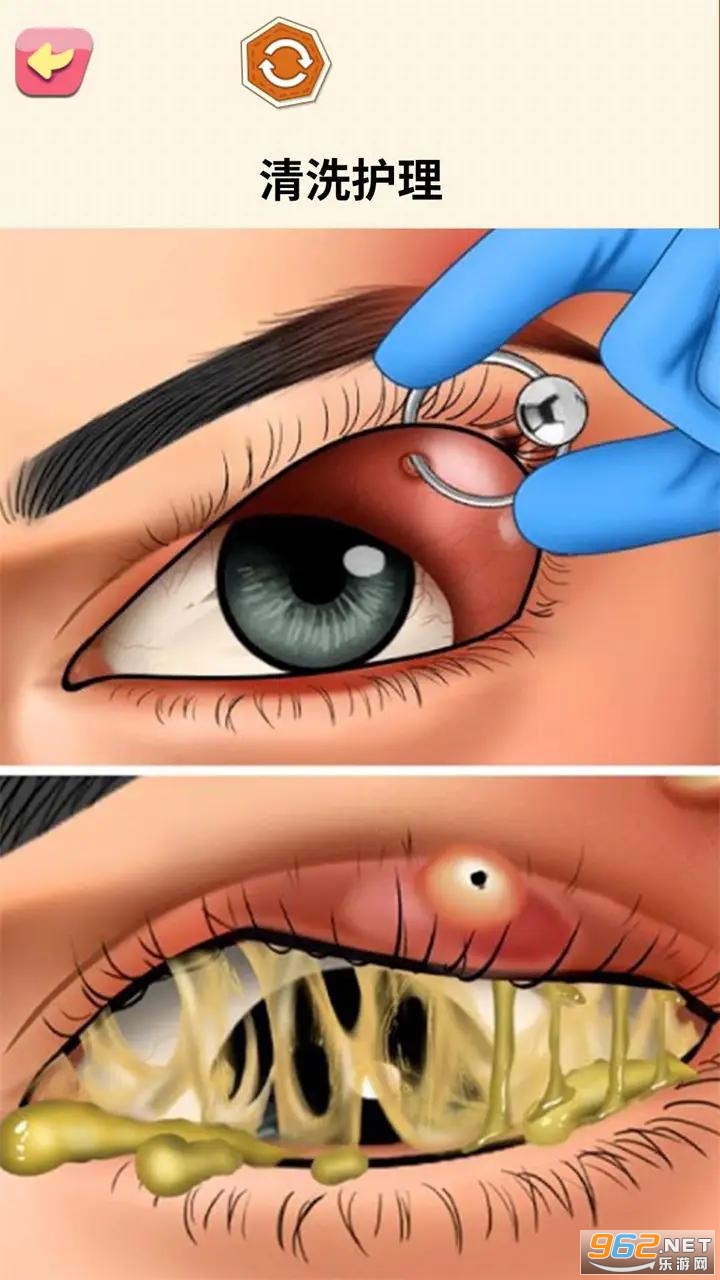 �����޶���ѹ��Ϸ��ͼ1