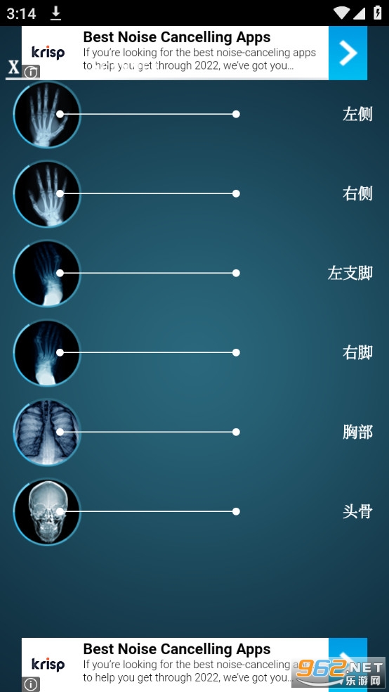手机骨骼扫描仪软件 手机骨骼扫描仪软件